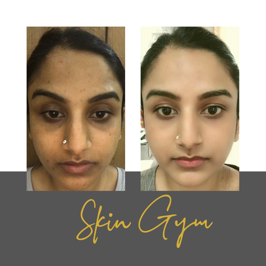 skin gym results