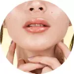 Undergo your treatment