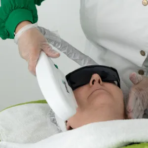 HIFU Facelift