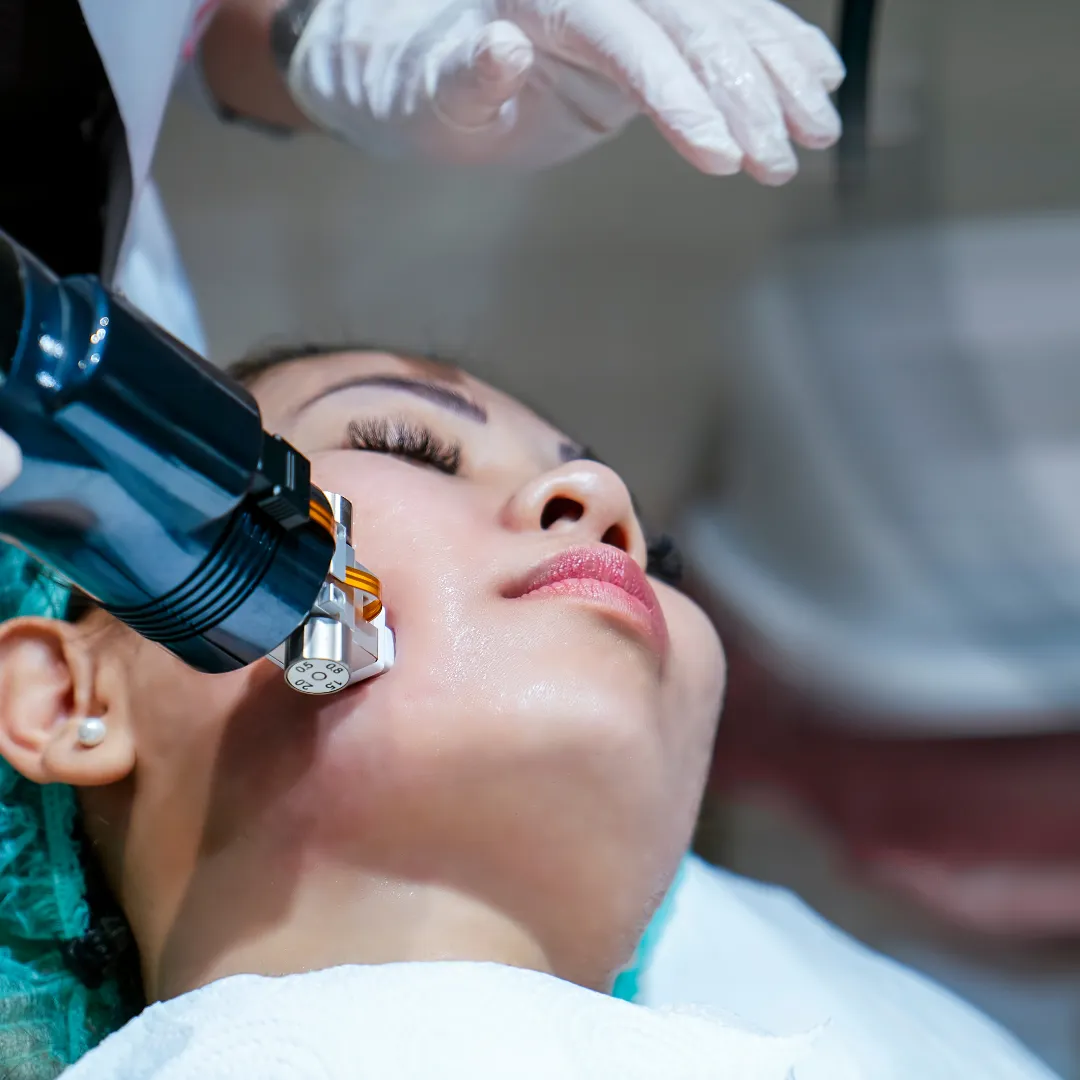 Radiofrequency microneedling