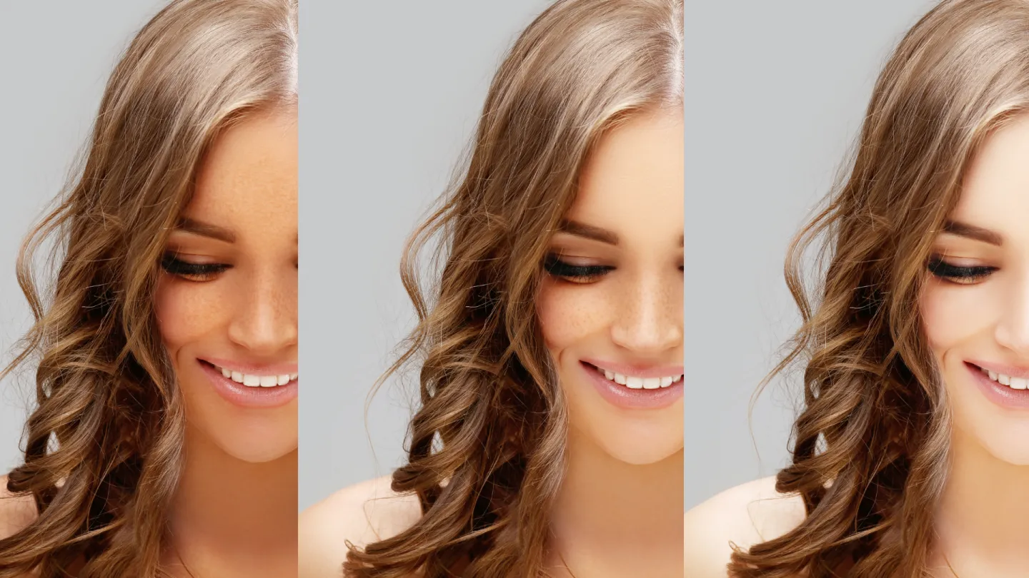 Skin Whitening Treatments: Which one to choose? Skin Whitening Treatments: Which one to choose?
