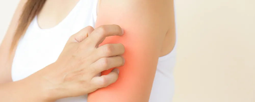 Eczema treatment in Mumbai