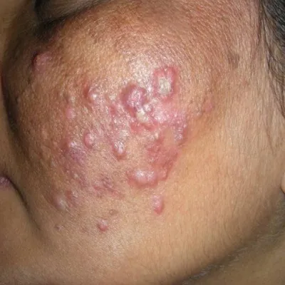 Dermacare illustration