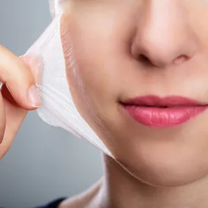 Chemical peels: Should they be done at home or at a clinic? Chemical peels: Should they be done at home or at a clinic?
