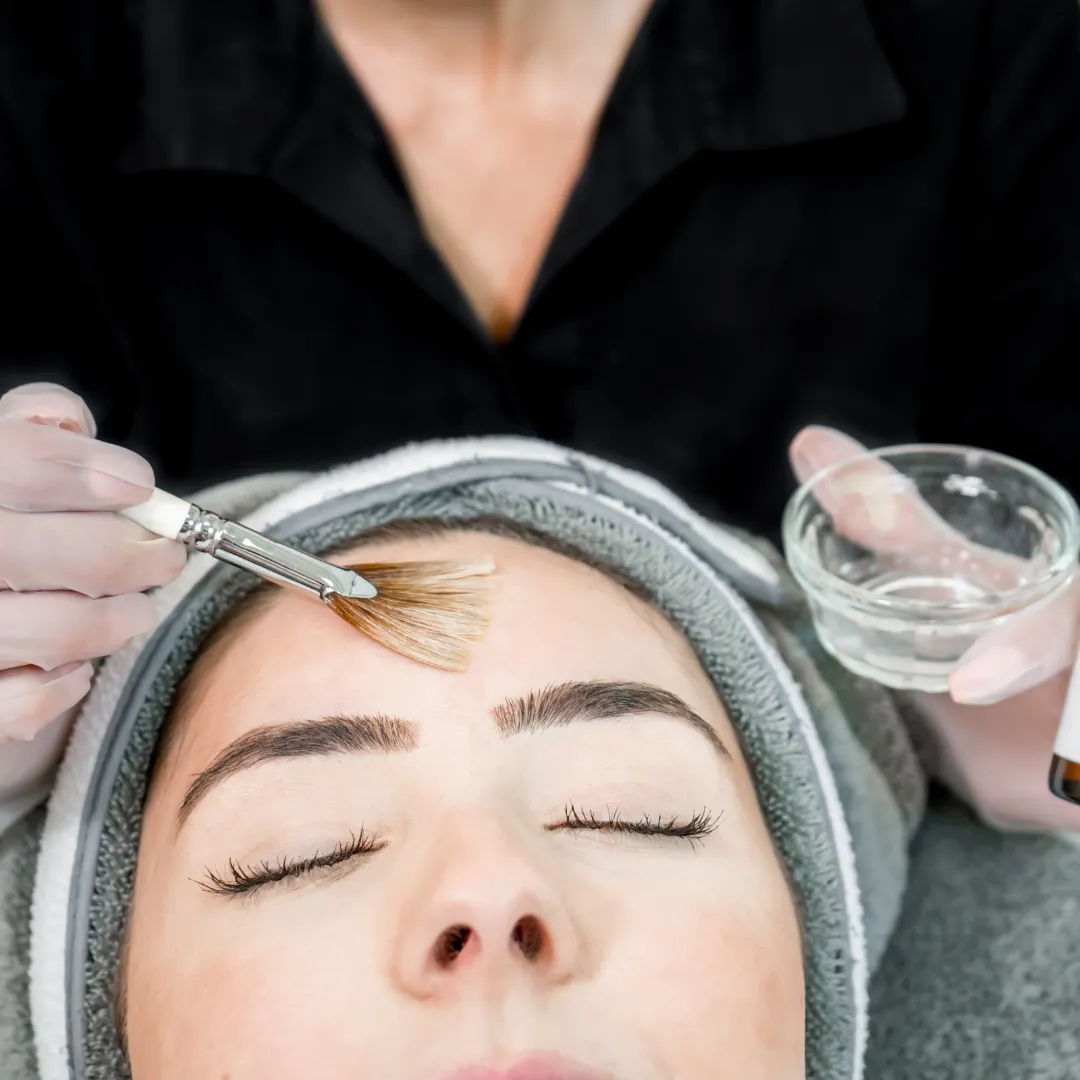 Salicylic peel Salicylic peel