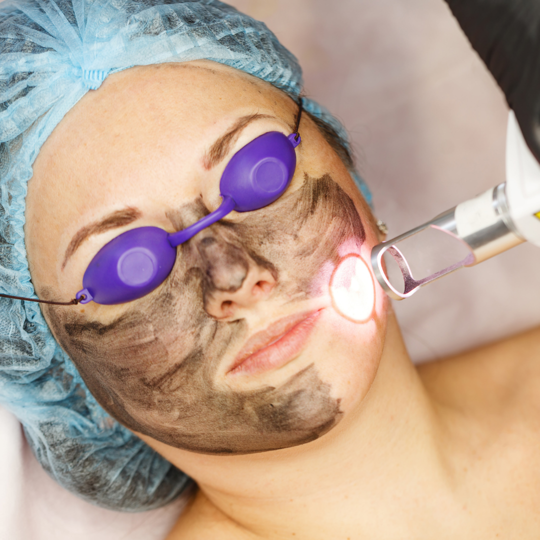 Best Carbon Laser Facial Treatment in Navi Mumbai with Latest Prices | Top  Carbon Laser Facial specialists Near Me in Navi Mumbai - SkinGenious May  2022