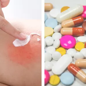 Skin medications Skin medications