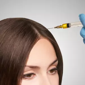 PRP hair treatment