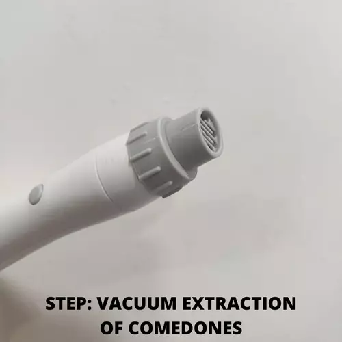 Vacuum extraction of comedones