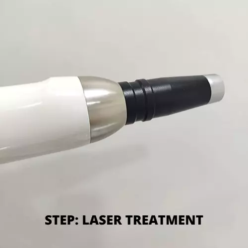 Laser light treatment