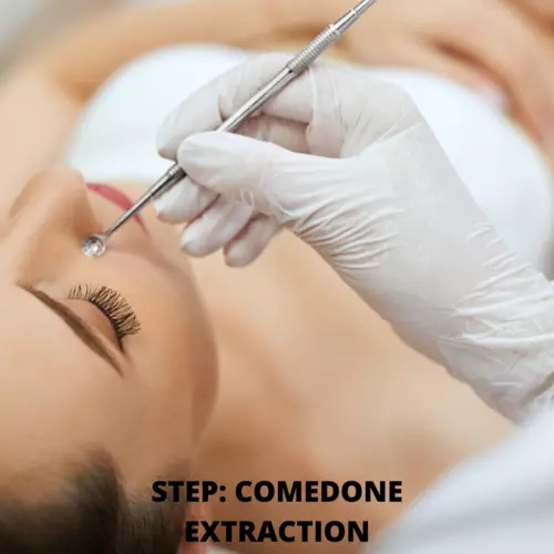 Extraction of Comedones